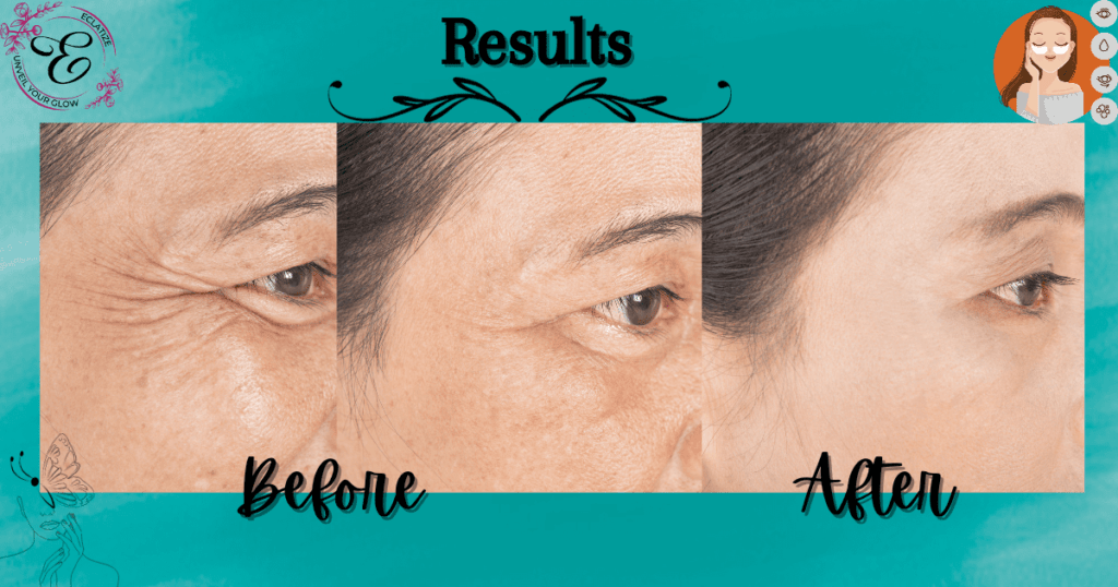 results of wrinkles schminkles solution