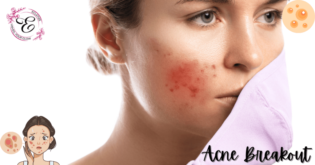 acne breakout